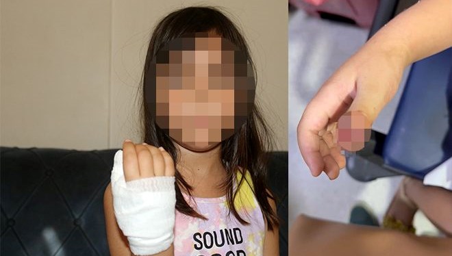 anaokulunda korkunc olay dort yasindaki cocugun parmagi koptu 4MK7YBpU