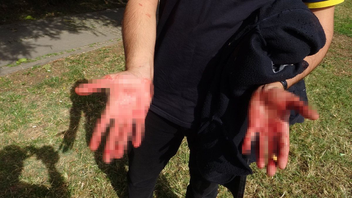 antalyada eline aldigi bicakla yoldan gecen vatandaslara saldirdi b38Jw8fN.jpg